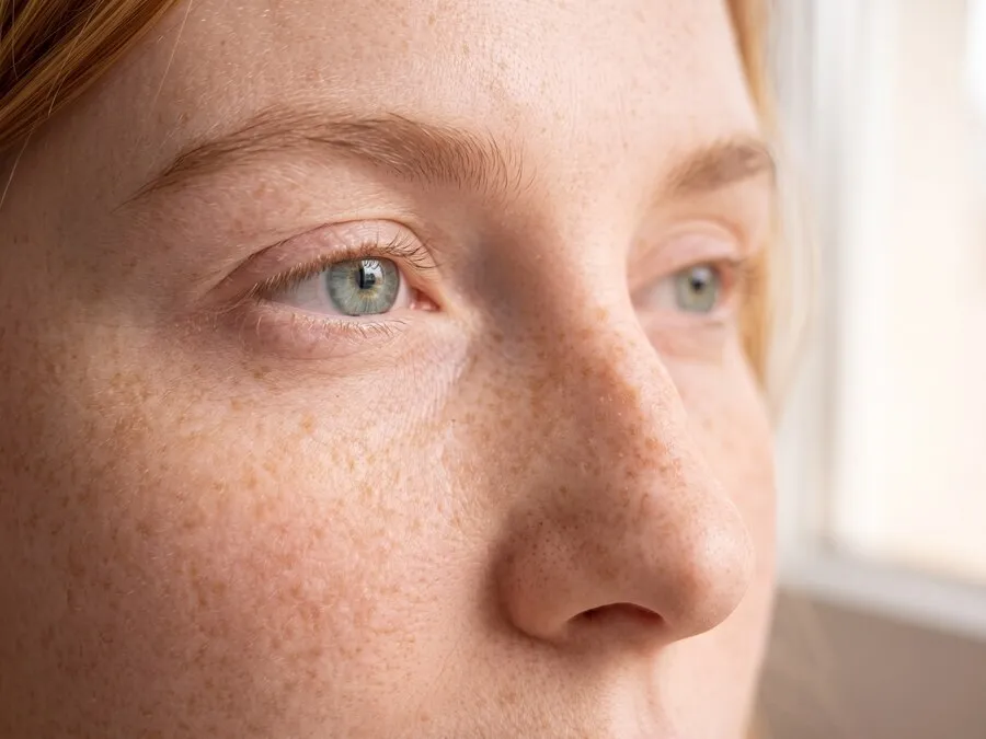 Scattered light freckles across the bridge of a young woman’s nose and her upper cheeks