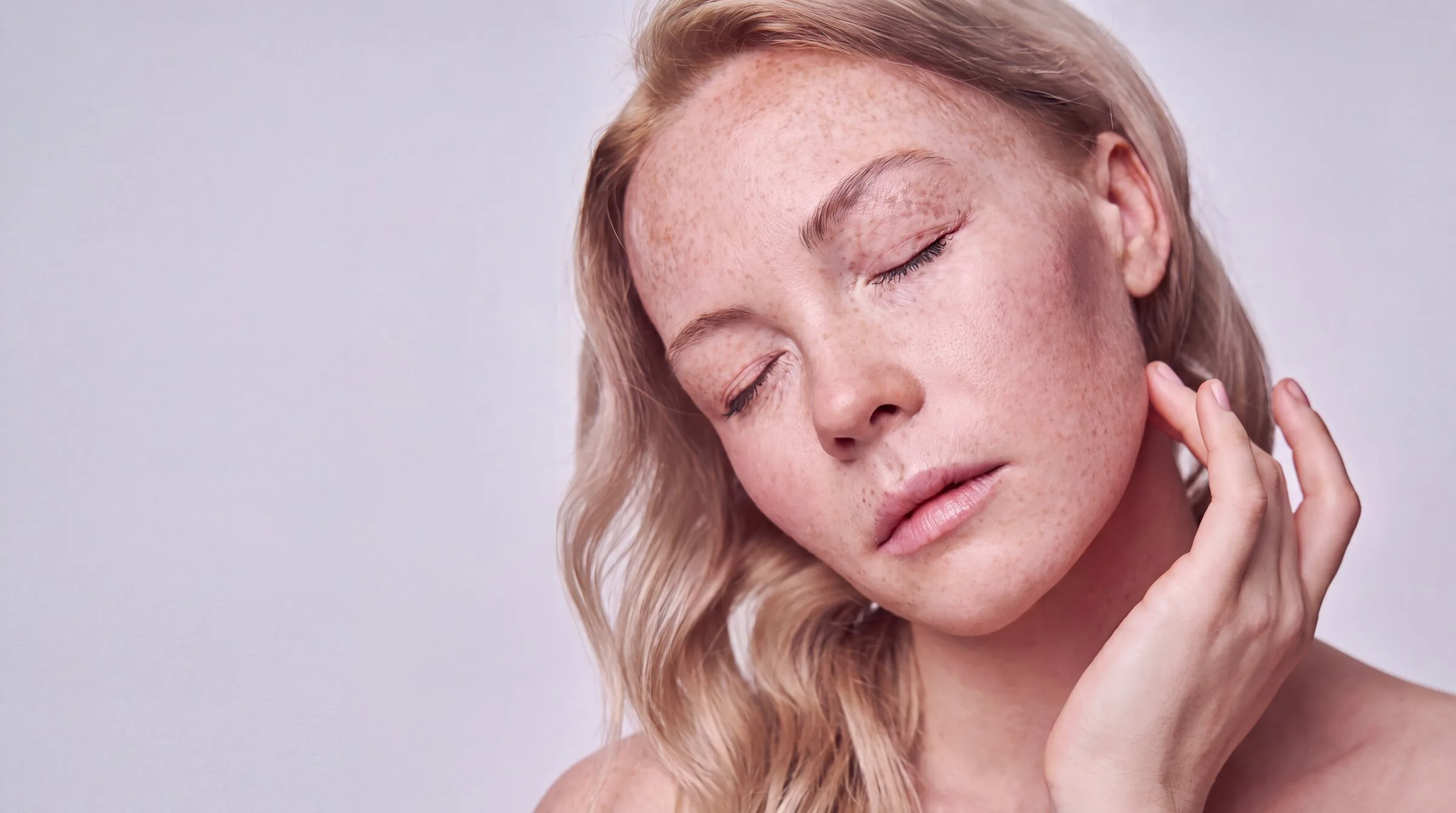A woman with her eyes closed and her own fingertips at the side of her neck, dense freckling and flat tan sun spots scattered over her forehead, nose and cheeks with a soft sun-flushed patch across the near cheekbone