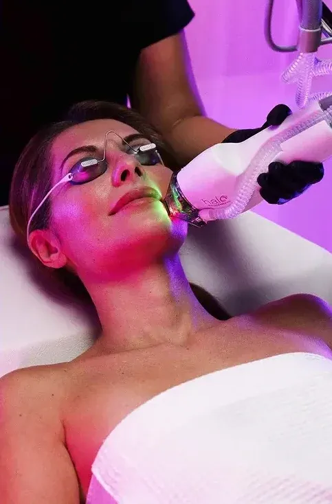 A halo handpiece treating a reclining patient's neck and décolleté with protective eye shields in place during a Halo Tribrid resurfacing session