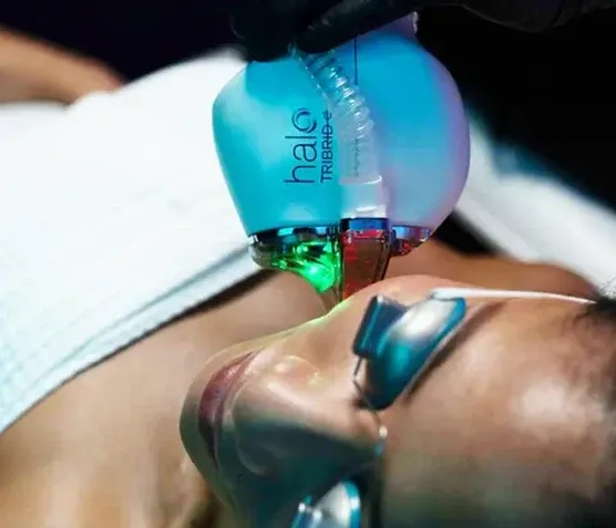 Close-up of the Sciton halo TRIBRID handpiece with its three emitter apertures lit in green, red and blue above a patient's cheek