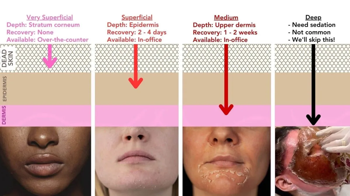 medium chemical peel before and after