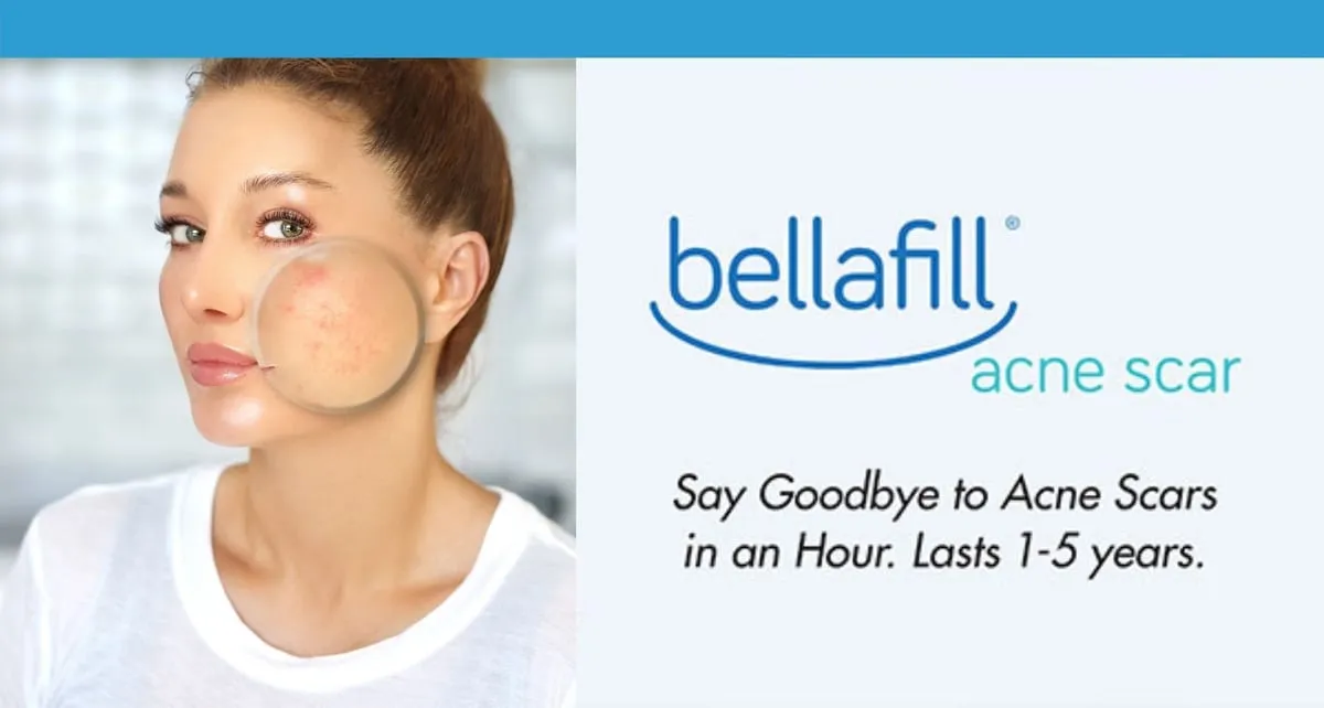 how is bellafill different