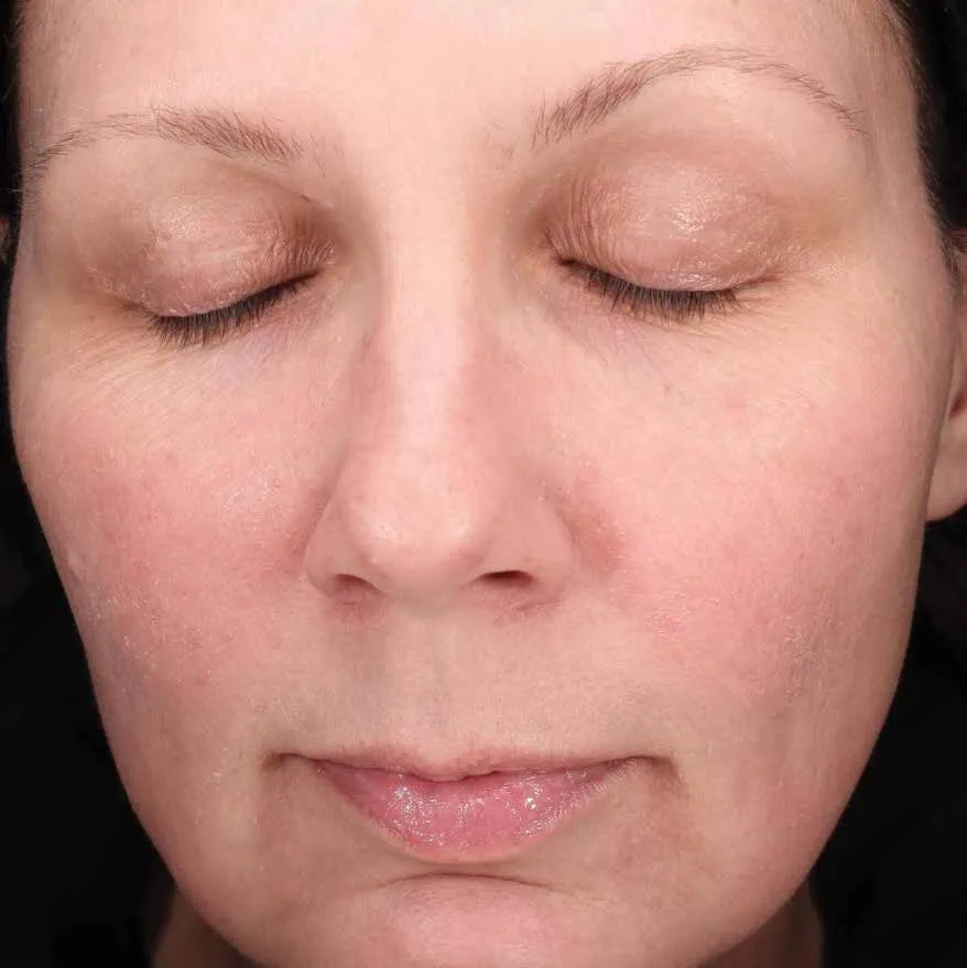 The same front view after Moxi, with the colour settled and the surface reading clearer