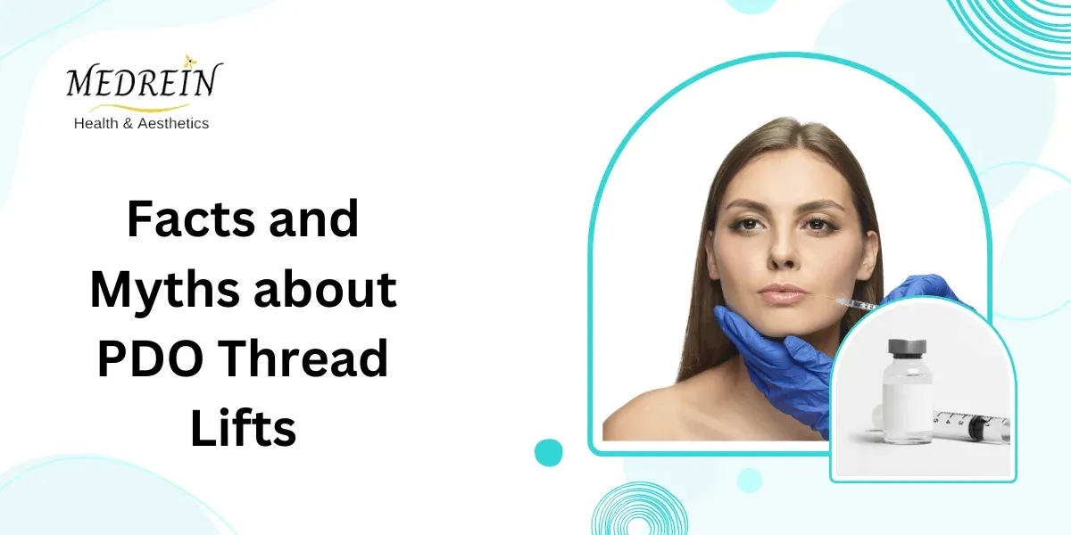 PDO Nova Thread Southlake TX: Facts You Need to Know