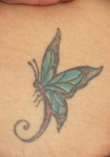 Lower back before laser tattoo removal, showing a teal and black butterfly with a long trailing swirl