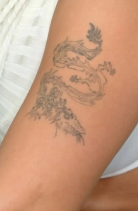 Inner upper arm before laser tattoo removal, showing a fine black dragon outline