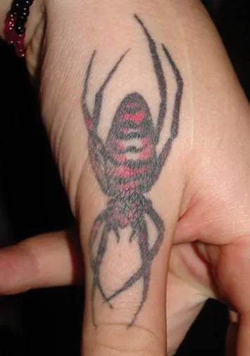 Back of a hand before laser tattoo removal, showing a black and red spider across the hand and thumb