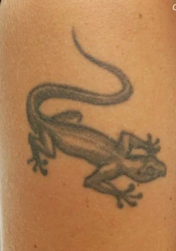 Upper arm before laser tattoo removal, showing a grey lizard with a long curling tail