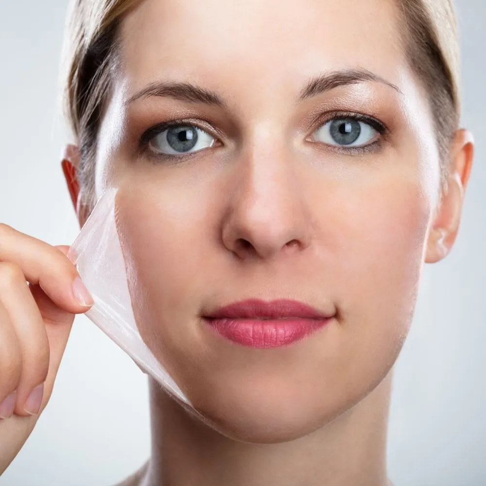 A woman lifting a translucent exfoliated layer away from her cheek after a chemical peel treatment