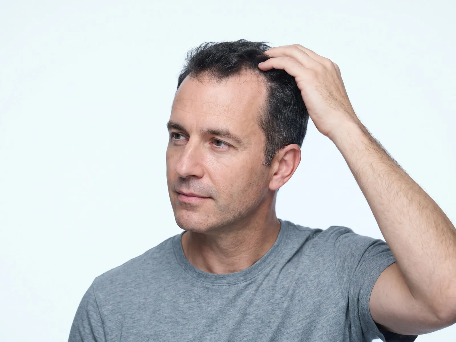 A man lifting the hair at his own temple to look at a receding front hairline, the area HaiRestart treats