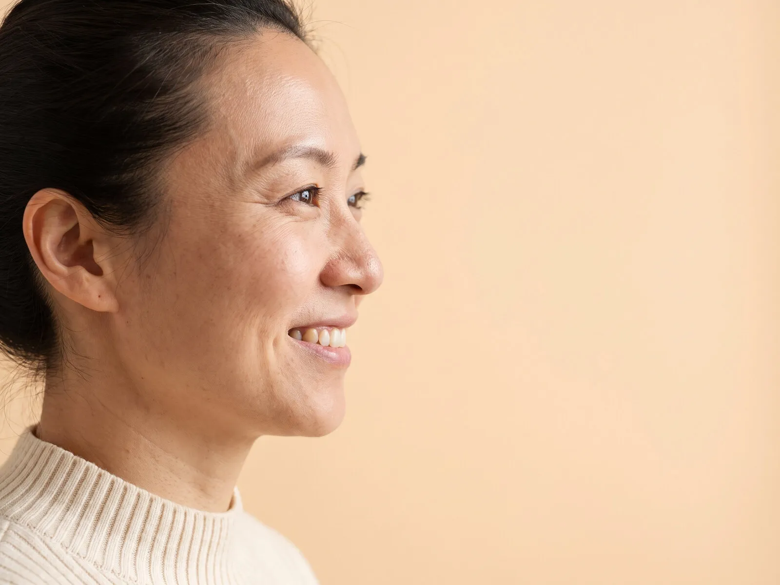A woman in her thirties photographed in profile, the bridge and tip of the nose a thread lift reshapes