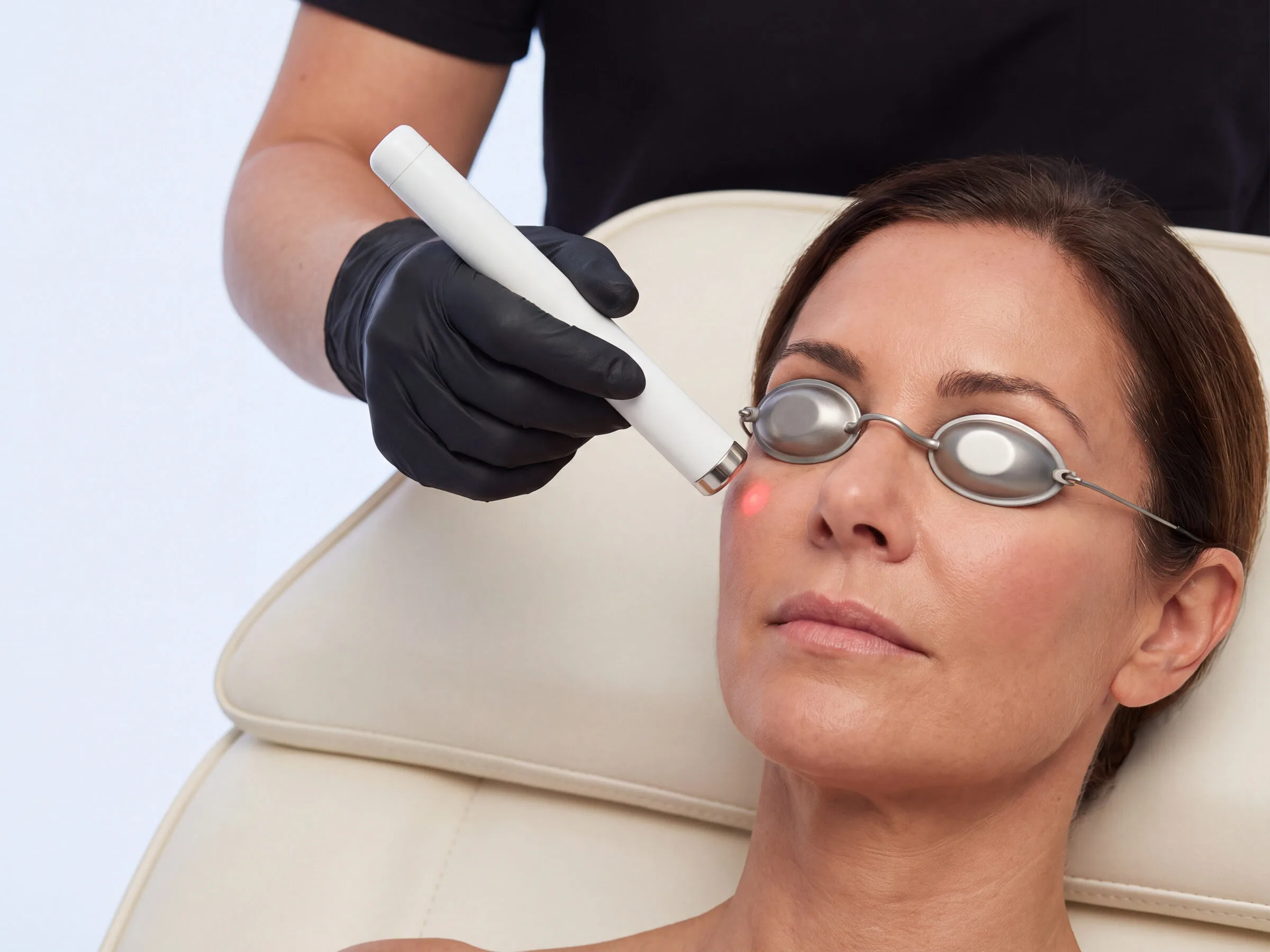 A clinician's gloved hand holding a slim laser handpiece just above the under-eye area of a woman reclined on a treatment couch, her eyes covered by opaque metal laser shields and a small red aiming light on the skin below her eye
