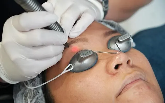 A gloved clinician holding a laser handpiece against the under-eye area of a patient wearing protective metal eye shields